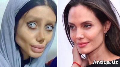 19 yoshli qiz kumiriga o'xshash uchun 50 marta jarroxlik stoliga yotqizildi